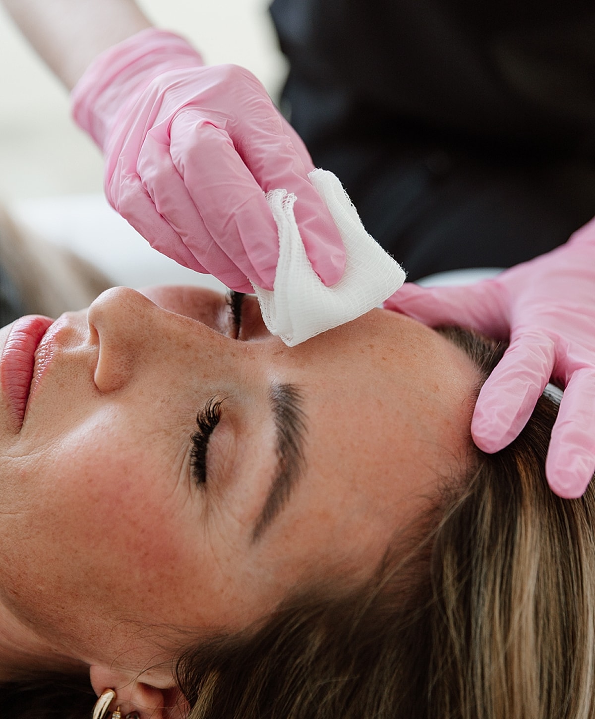 Skin treatment with gloved hands and cotton pad.