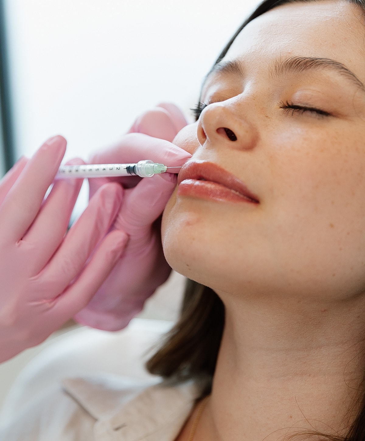 Cosmetic procedure: lip filler application session.