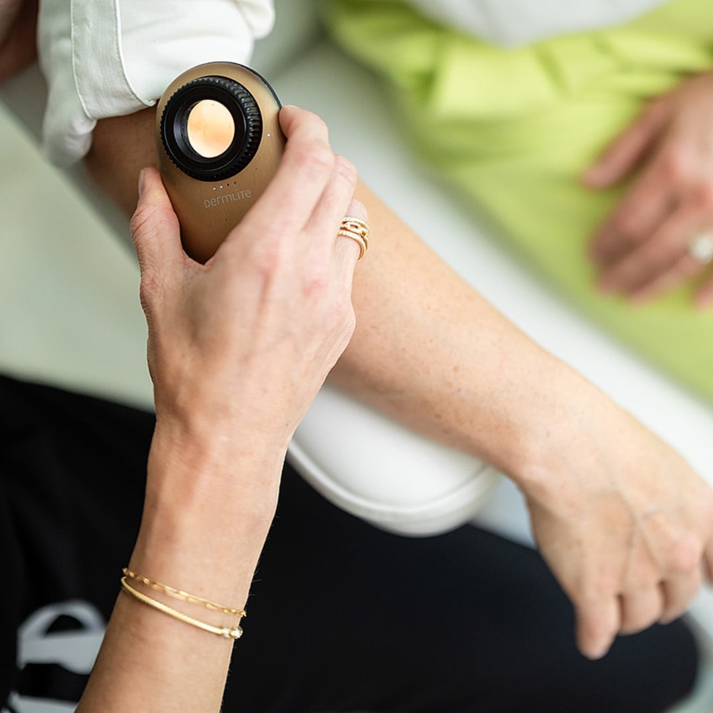Skin analysis with handheld device on arm.