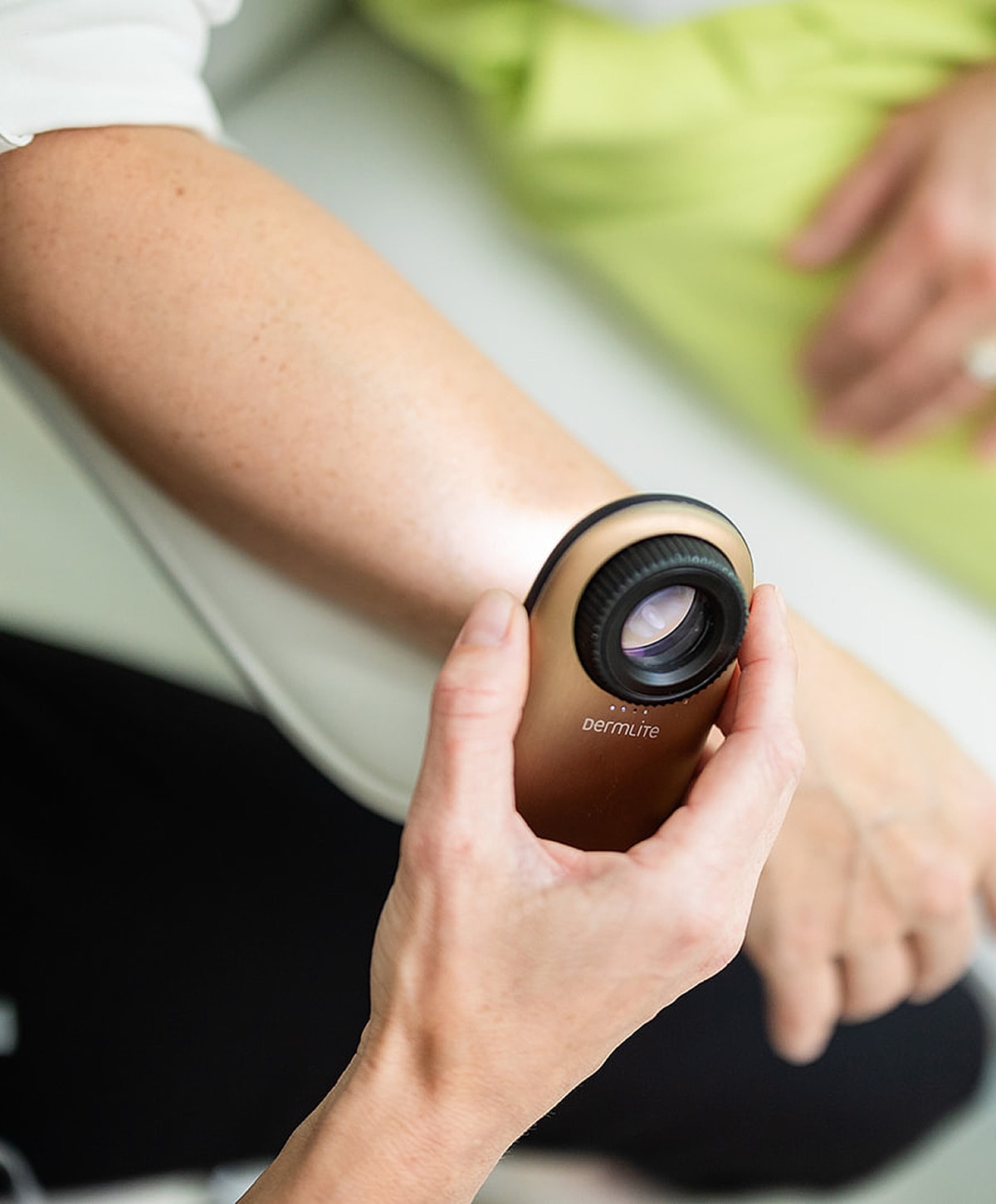 Hand holding a skin examination device on arm.