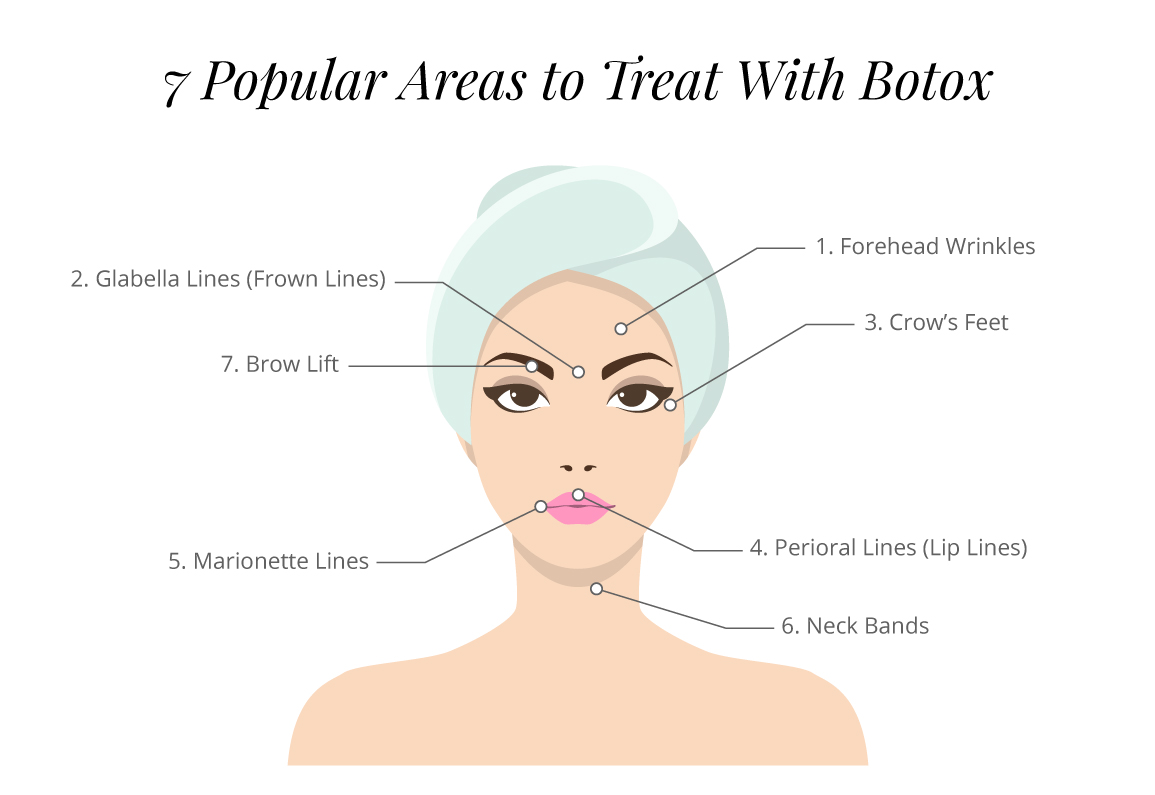 WIPS Botox Graphic